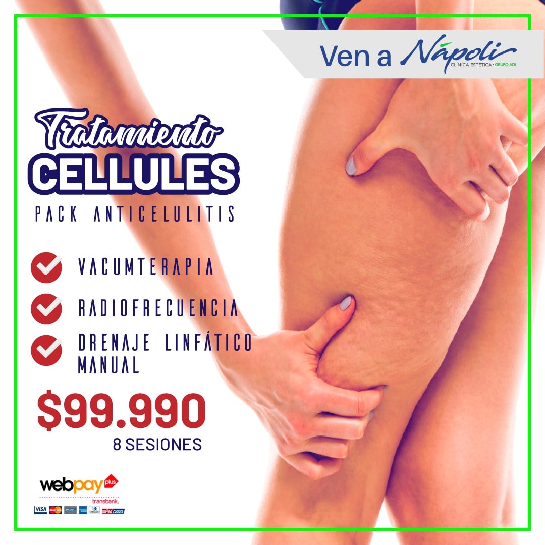 Tratamiento Anti Celulitis – Clinica Napoli
